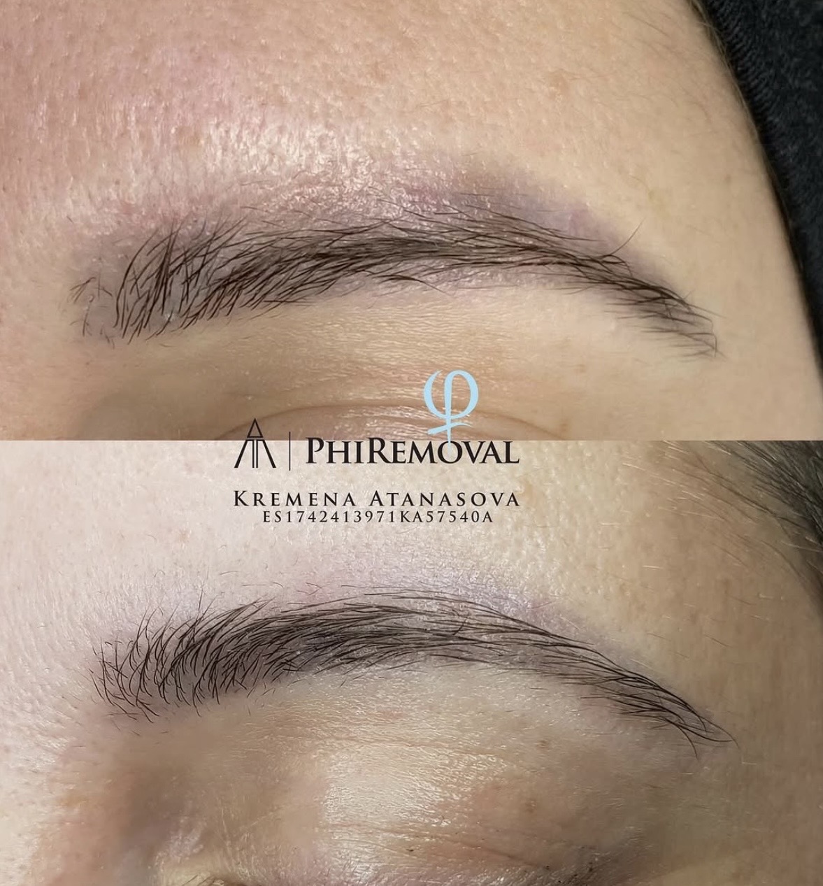 PhiRemoval — резултат
